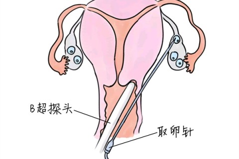 http://baoding.vdtfzz.com/post/205.html|保定供卵助孕